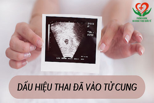 dấu hiệu thai đã vào tử cung