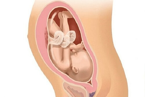 Ngôi thuận của thai nhi là gì?