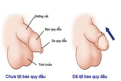 cách lột bao quy đầu tại nhà