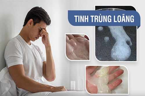 nguyên nhân tinh trùng loãng