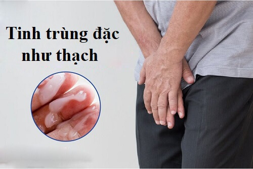 tinh trùng đặc như thạch