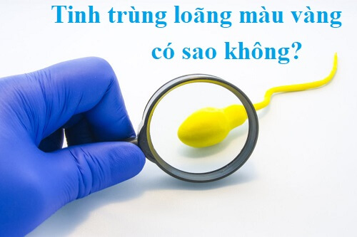 Tinh trùng loãng màu vàng có sao không