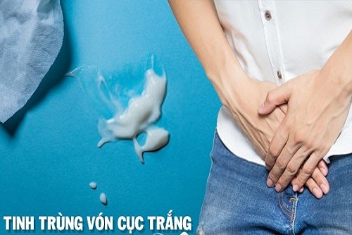 Tinh trùng vón cục màu trắng nguy hiểm không