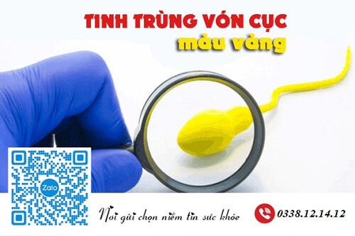 Tinh trùng vón cục màu vàng có nguy hiểm không?