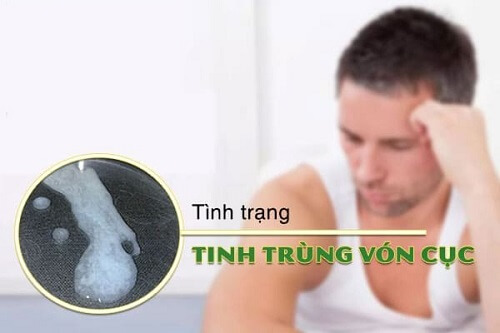 Tinh trùng vón cục