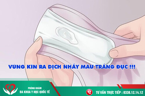 dịch nhầy màu trắng đục