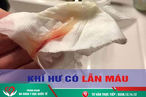 điều trị khí hư kèm máu