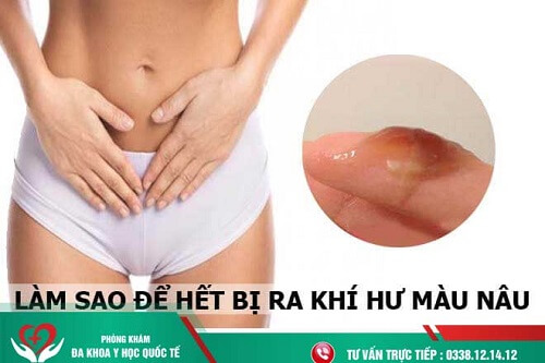 khắc phục ra khí hư màu nâu